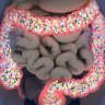 Nutrition and Health: Human Microbiome